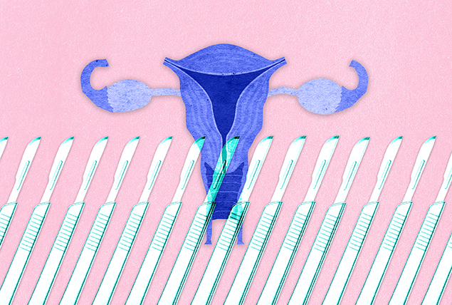 A row of scalpels is layered over a purple image of a reproductive system and a pink background.