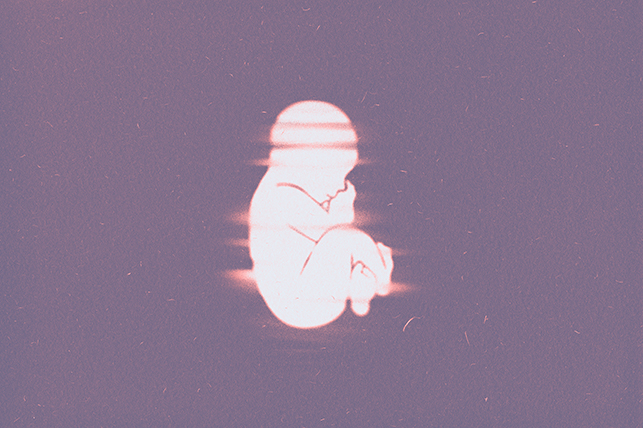 A white fetus lays against a purple background with light red lights across it.
