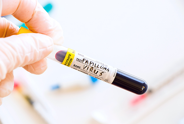 A vial holds blood for HPV testing.