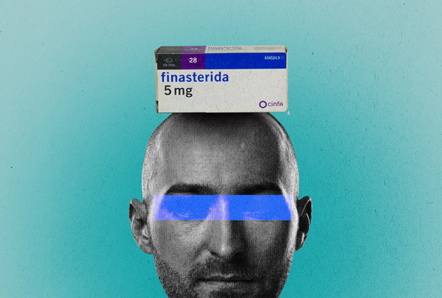 A box of Finasteride sits on top of the bald head of a man.