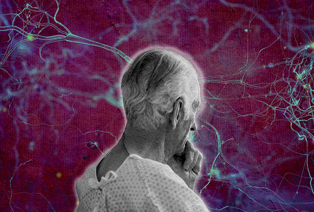 An older man holds his chin as he looks away with a background of pink and blue brain tissue.
