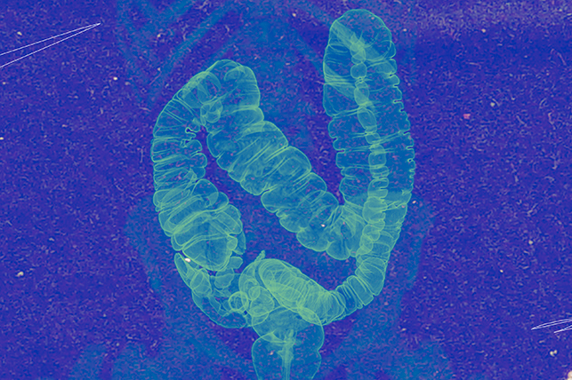 A green transparent image of a colon is against a purple background.