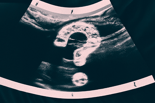 An ultrasound of a pregnancy has a large question mark over it.