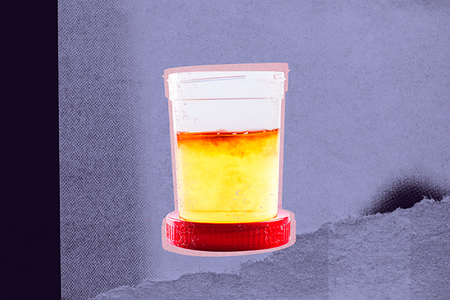 An open cup of urine is standing on top of its red lid.