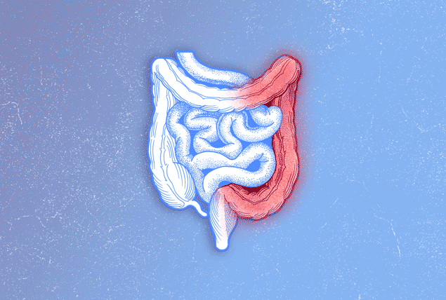 a light blue digestive tract with one side in red on a blue background
