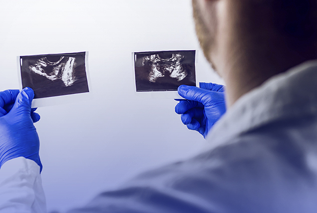 a doctor in blue gloves looks at two ultrasound images on a white background