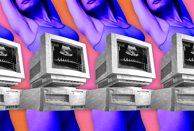 black and white computers with ultrasound images on a background of women with purple tint stretching