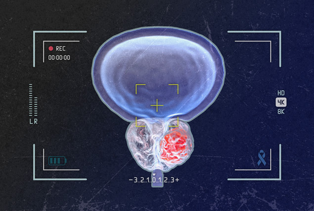 x-ray of prostate organ with a red highlighted region on a black background