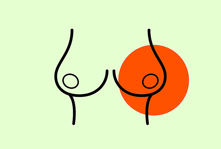 green outline of a pair of breasts on green background with red circle over left breast