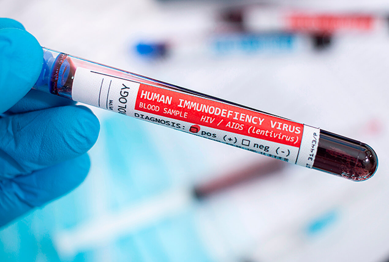 A gloved hand holds a test tube full of blood labeled as human immunodeficiency virus.