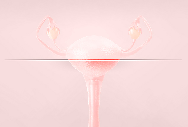 light pink uterus sliced in half with a line on a light pink background