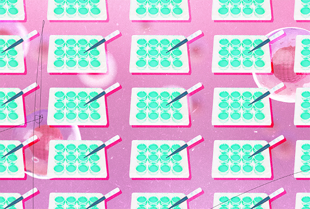 A tray of samples are tested for HIV.