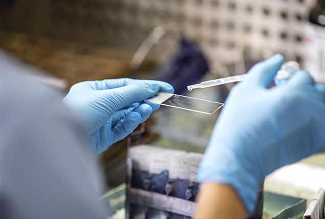 blue gloved hands drip a liquid from a pipette onto a microscope slide