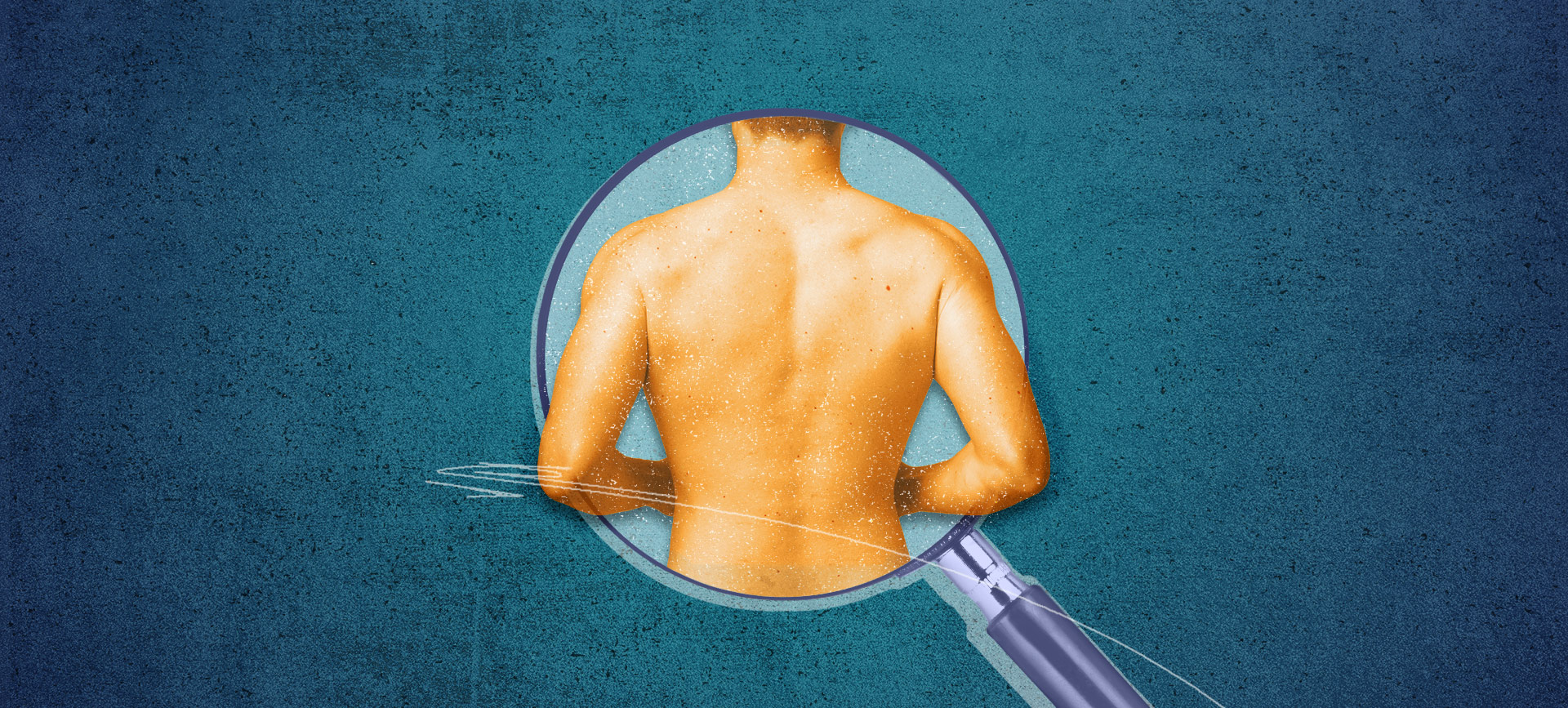 bare man's back in magnifying glass on dark blue background