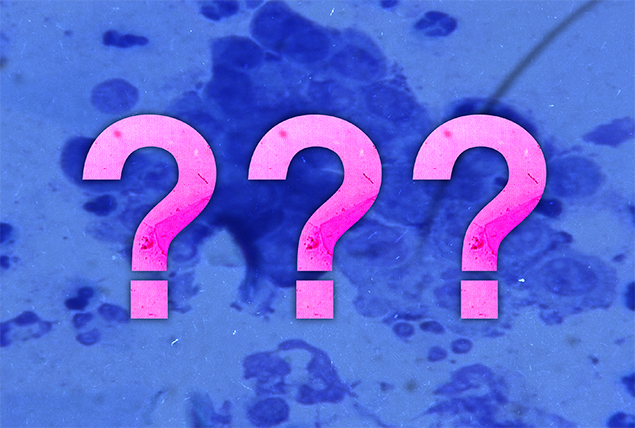 hot pink question marks on blue tinted virus background