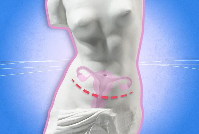 marble statue with c-sectile dotted scar and reproductive organ visible on blue gradient background