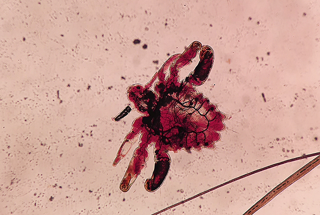 red cross section image of louse under microscope