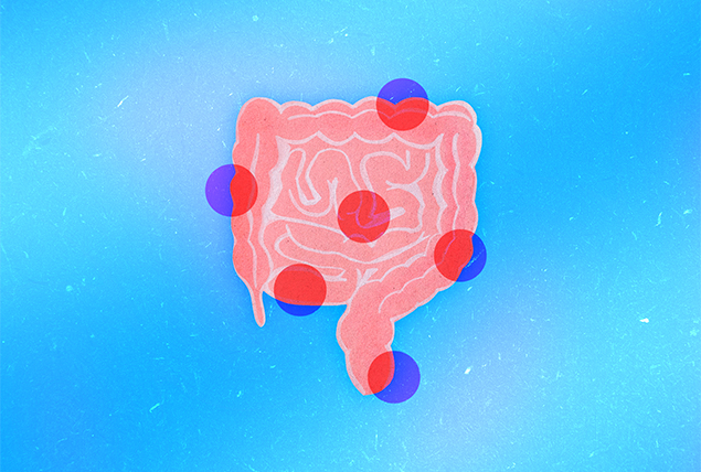 A pink image of the digestive tract has red circles at various points.