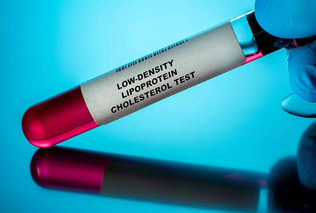A vial of blood has a label on it for a low-density lipoprotein cholesterol test. 