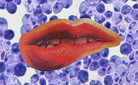 Yeast fungus behind an image of a mouth biting its lip.