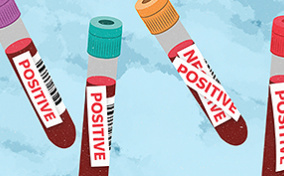 Four false positive chlamydia test vials.