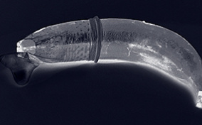 A black background features an X-Rayed banana wearing a condom.
