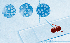 There's blood on a glass microscope slide that's in front of blue images from a microscope.