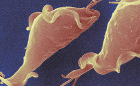 Trichomoniasis bacteria in orange lay against a blue background.