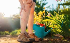 A woman standing in their garden is holding their knee and their calf in pain from deep vein thrombosis.