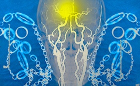 An x-ray of a human skull is surrounded by links and has a yellow spot in the brain.