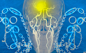 An x-ray of a human skull is surrounded by links and has a yellow spot in the brain.