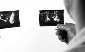 A doctor looks at an x-ray of a prostate.