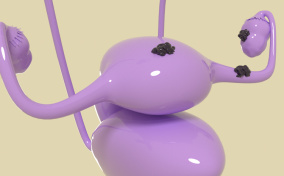 A purple, plastic female reproductive system has dark cells growing in clumps on the outside, depicting endometriosis.