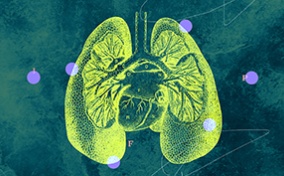 A yellow outline of the lungs and heart area is spotted with pink circles against a green background.