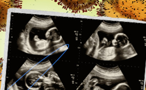 An ultrasound of a baby is laying on top of orange monkeypox virus cells.