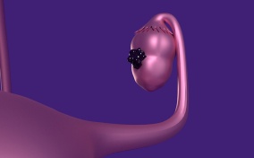 A plastic, purple ovary grows dark cells.