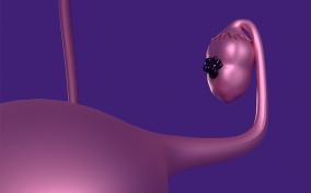 A plastic, purple ovary grows dark cells.