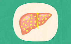 A liver with yellow fat spots sits on a cream colored plate and a green background.