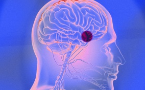 A pink x-tray of a brain has a red dot over the pituitary gland with a blueish background.