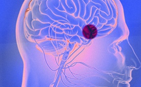 A pink x-tray of a brain has a red dot over the pituitary gland with a blueish background.