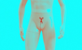 A male Barbie doll has a red incision line and scissors on the groin area against a bright teal background.