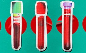 Three vials of blood with different caps are on top of a teal background with red circles.