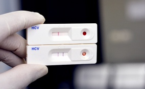 A positive test for Hepatitis C is held up together with a negative test.