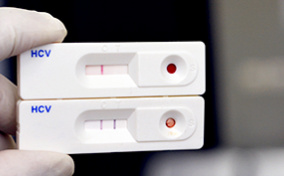 A positive test for Hepatitis C is held up together with a negative test.