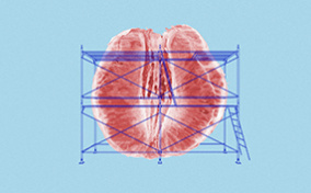 Half of an peeled grapefruit sits against a blue background with scaffolding around it.