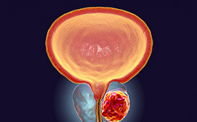 A male prostate glows in orange against a dark blue background.