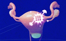 The female reproductive system sits against a blue background as a white cloud with three exclamation points hovers over it.
