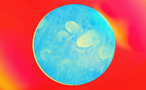 Tiny bumps on the skin of a penis are viewed through a blue microscopic lens against a red and yellow background.