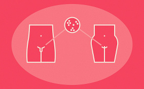 An outline of both male and female genital areas are connected by a dotted line coming from a virus cell.