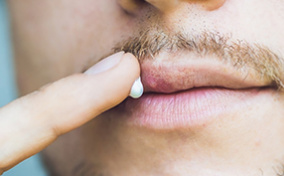 A man is putting white ointment onto his lips.